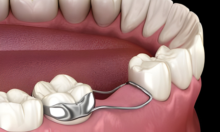 Best Dental Space Maintainer for Kids in Govind Nagar, Nashik